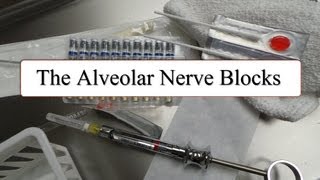 The Alveolar Nerve Blocks [upl. by Hachmann]