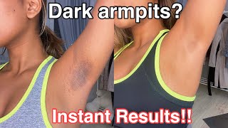 How To Get Rid Of Dark Armpits INSTANTLY 100 works [upl. by Etz892]