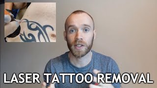 Laser Tattoo Removal  Sessions 13 Update [upl. by Dniren]