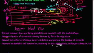 54  Turbulence Stasis Thrombosis Virchows triad Laminar blood flow [upl. by Oah242]